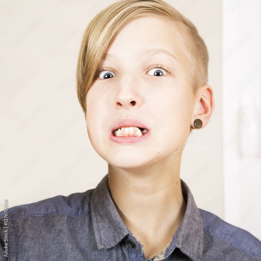 Teenager with an uneven row of teeth to the installation brackets.Orthodontics and bite correction. Teenager with an uneven row of teeth to the installation brackets.Orthodontics and bite correction.