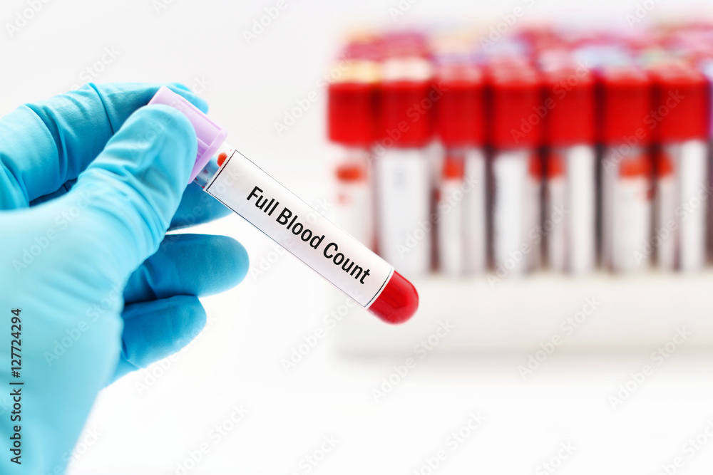 Fototapeta premium Full blood count (FBC) test