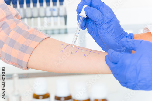 Allergy tests in laboratory photo