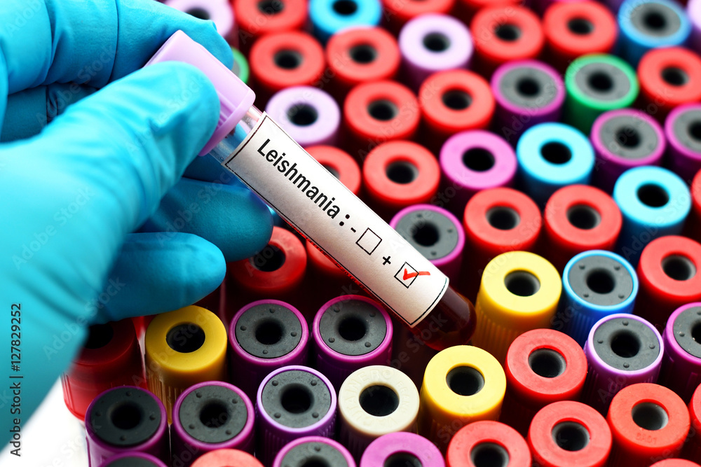 Fototapeta premium Blood sample for Leishmania parasite test