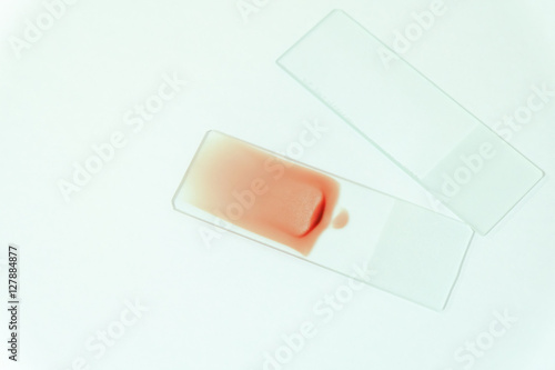 Blood smear for hematology microscopic examination photo