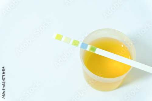 Urine sample for laboratory analysis photo