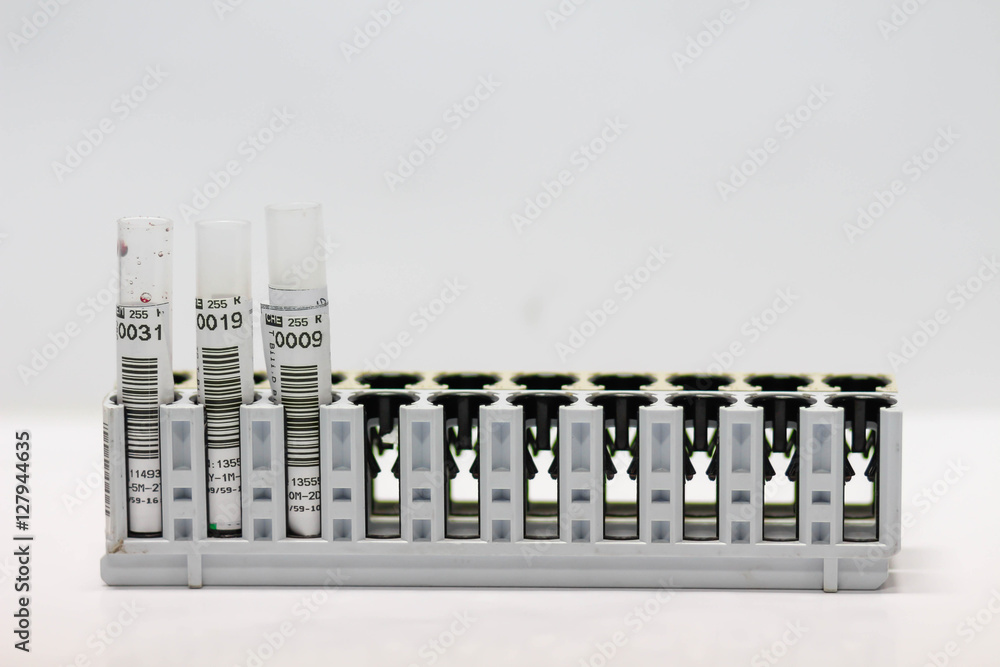 Test tube in a laboratory Test tube in a laboratory