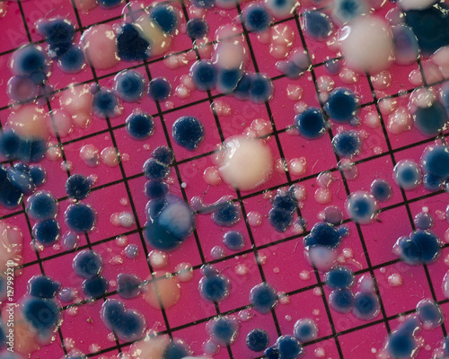 Escherichia coli colonies