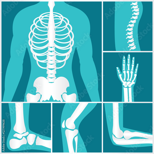 Set of xray of human skeletal.