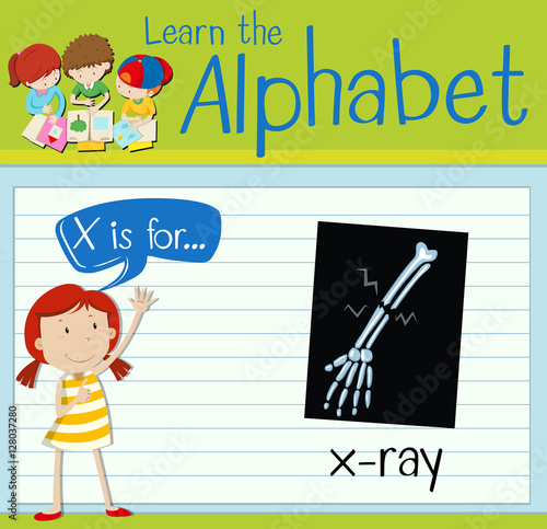 Flashcard letter X is for x-ray