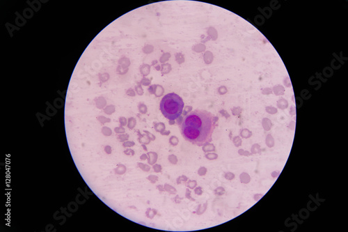 mesothelial cell