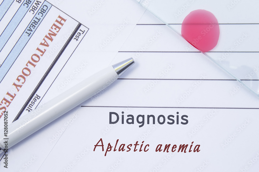 Diagnosis Aplastic anemia. Written by doctor hematological diagnosis Diagnosis Aplastic anemia. Written by doctor hematological diagnosis