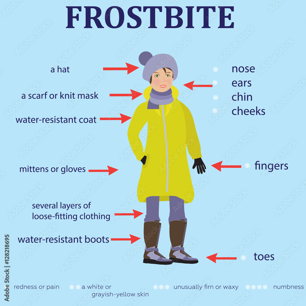 Frostbite. How to prevent. Often zone lesions and symptoms. Frostbite. How to prevent. Often zone lesions and symptoms.