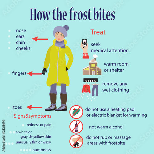 Frostbite - zone lesions, symptoms, treatment, prohibition