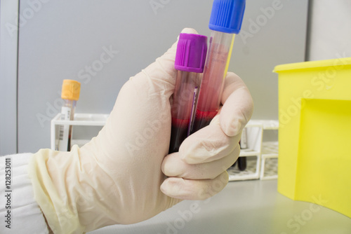 blood tests at a private clinic