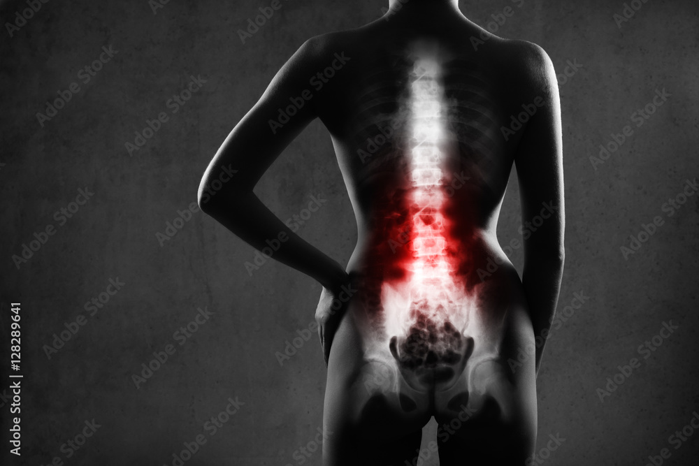 Fotografie Human spine in x-ray, on gray background.