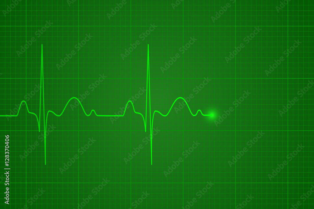 Heartbeat on the monitor, vector illustration, background Heartbeat on the monitor, vector illustration, background