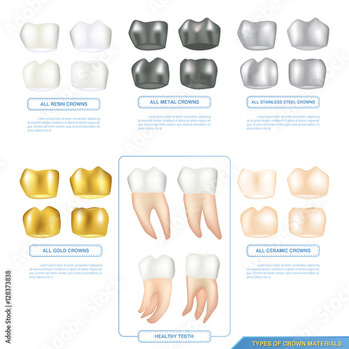 infographics types of dental crown materials with healthy teeth, ceramic, resin, metal and stainless-steel