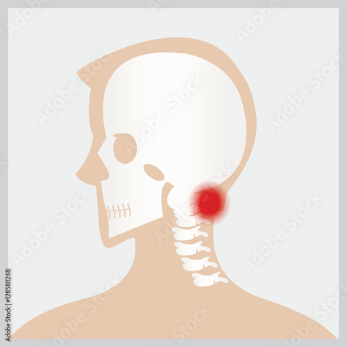 Disease of  head and neck.
