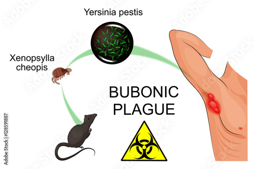 bubonic plague photo