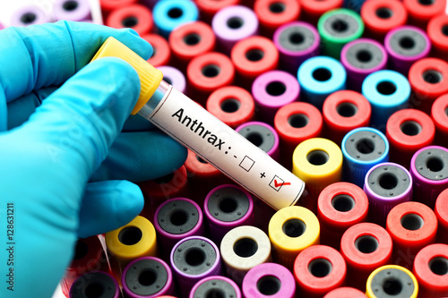 Tableau sur toile Anthrax positive