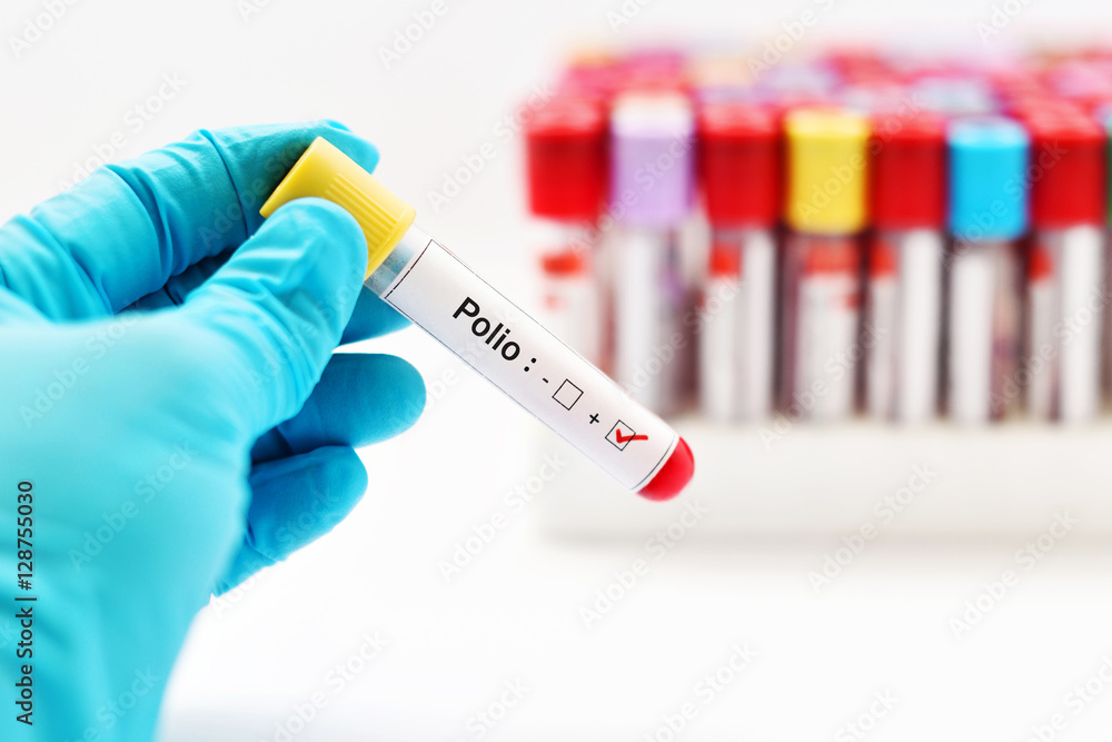 Fototapeta premium Polio positive