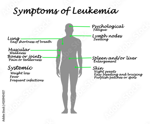 Common Symptoms of Leukemia.