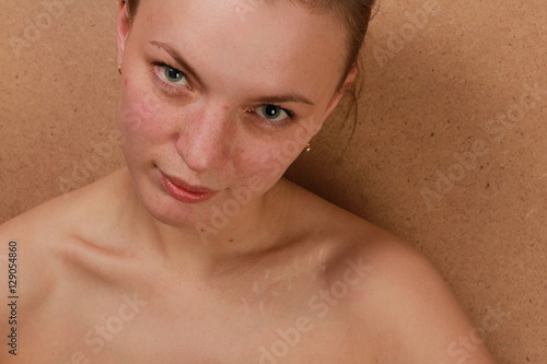 closeup girl portrait with a scar on a clavicle 