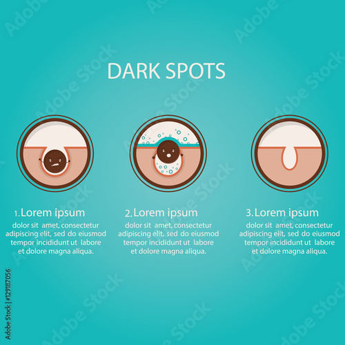 Modern vector illustration of skin problems. Acne. Face care. Template for website