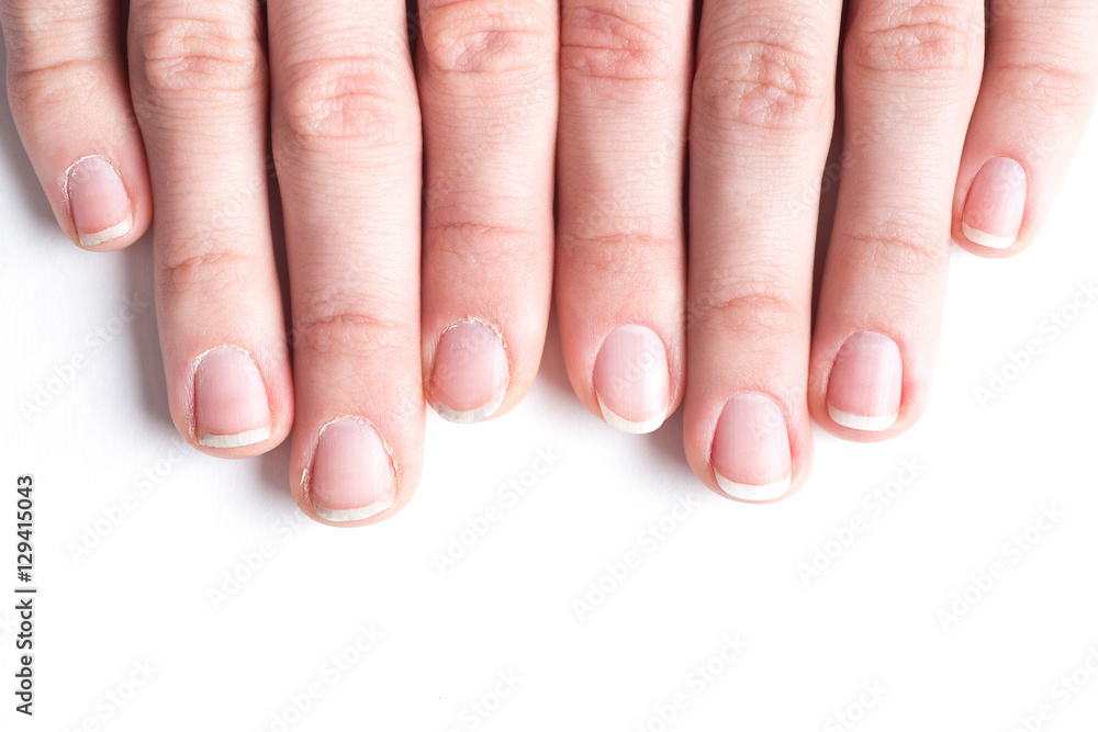 Comparison of the beautiful and the ugly manicure Comparison of the beautiful and the ugly manicure