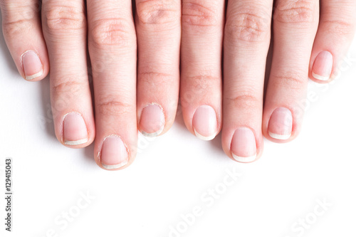 Comparison of the beautiful and the ugly manicure