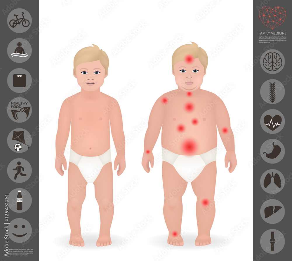 Body of a child, thick and thin , pain points, detailed vector i Body of a child, thick and thin , pain points, detailed vector i