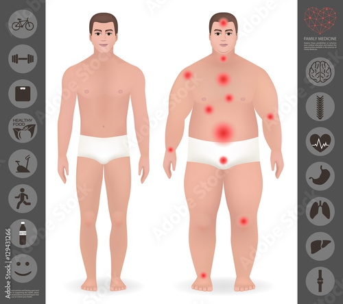 Body of a man, thick and thin , pain points, detailed vector ico