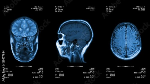 Head MRI scan. Loopable. Blue.