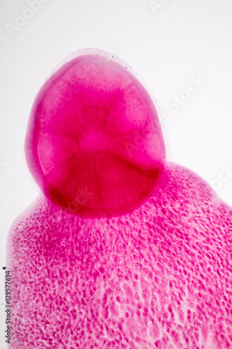 Flukes infestation (parasite) under microscope view.