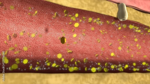 Process of urine formation