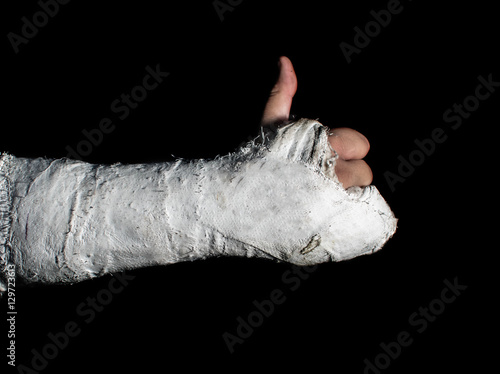 Arm in a cast giving thumbs up