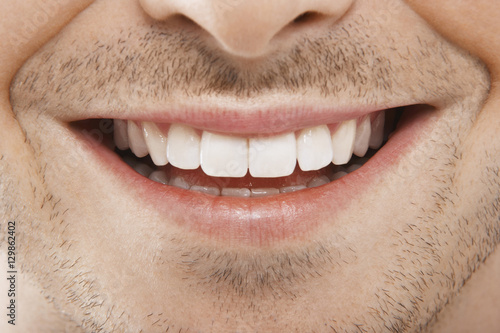 Tablou pe pânză Detailed image of young man smiling with perfect white teeth