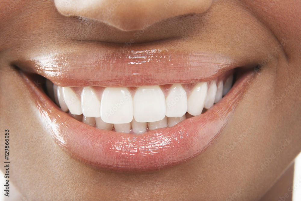 Fototapeta premium Closeup of woman smiling with perfect white teeth