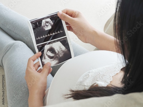 Pregnant woman holding ultrasound scan. Concept of pregnancy healthcare.