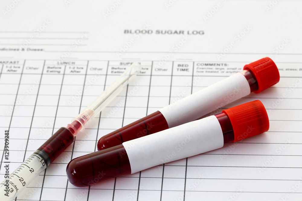 Syringe and plastic test tube with blood in laboratory Syringe and plastic test tube with blood in laboratory