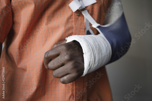 Closeup midsection of a man with broken arm in cast photo