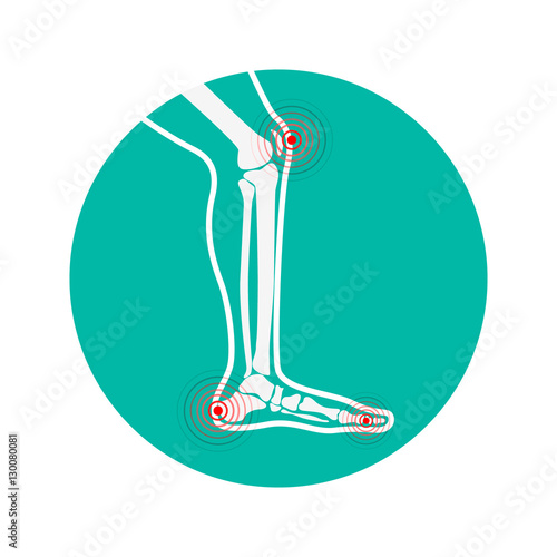 Human leg pain zones. Design elements for infographic. Vector illustration.