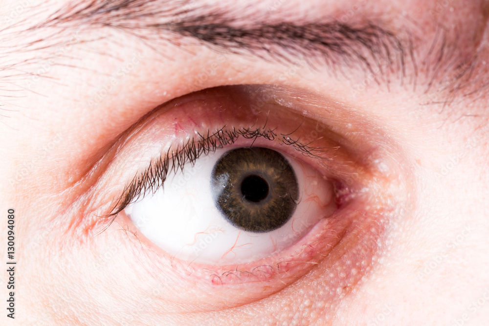 Obraz premium Glass eye prosthetic Ocular prosthesis