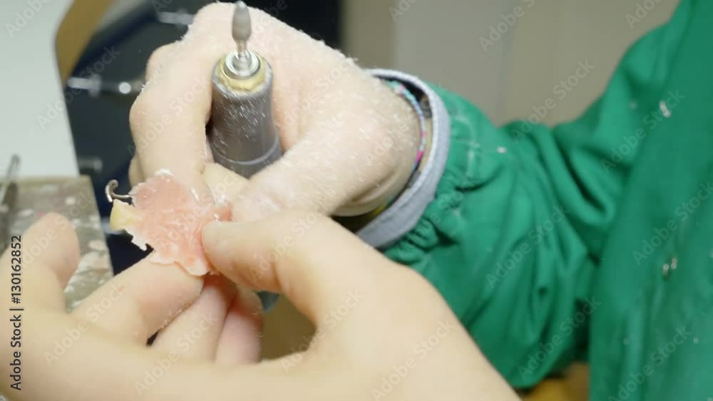 prosthodontics expert shapes a dental prosthesis, working with a chisel