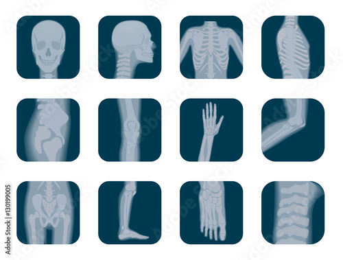 Vector realistic X-ray skeleton icons set. Human Skeleton xray elements. Body parts icon.