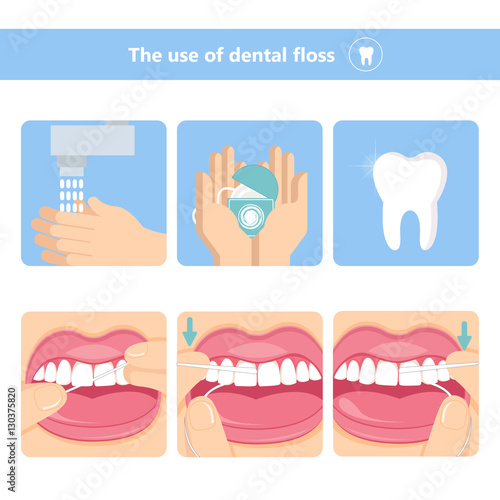 Dental floss how to use vector illustration. Thread for teeth. Oral hygiene. Dental Care. Removal of food residues