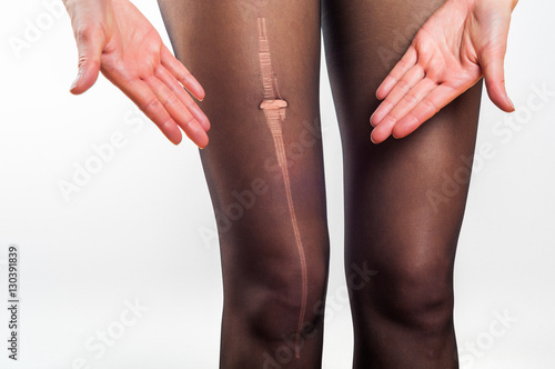 woman stressed about torn tights photo