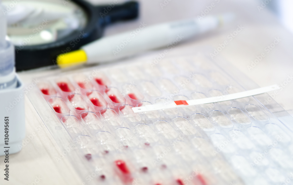 Litmus strips for blood analysis on pallets with the blood to determine the Rh factor. Litmus strips for blood analysis on pallets with the blood to determine the Rh factor.
