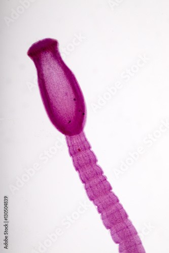 Senga Chiangmaiensis parasite on slide under microscope view.