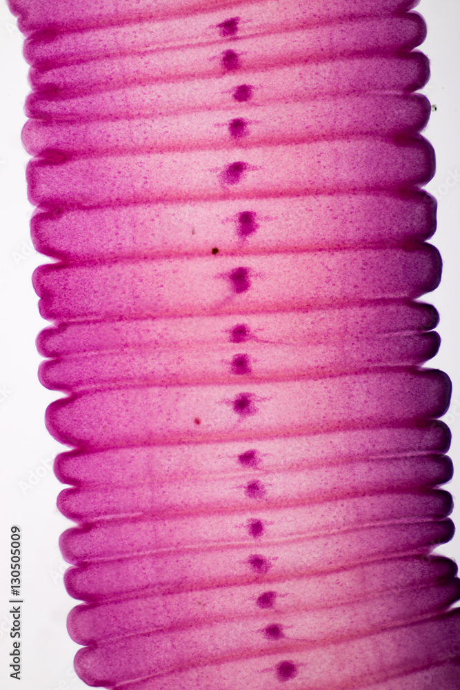 Senga Chiangmaiensis parasite on slide under microscope view. Stock ...