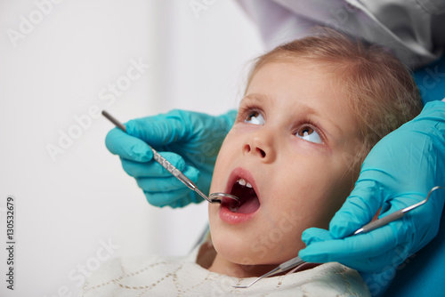 Milk teeth disease. Woman doctor examining child mouth with mirror. 