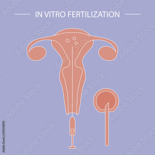 In vitro fertilization flyer. Illustration showing fertilization in laboratory, fertilized egg development and embryos transfer back to the uterus. Vector conceiving