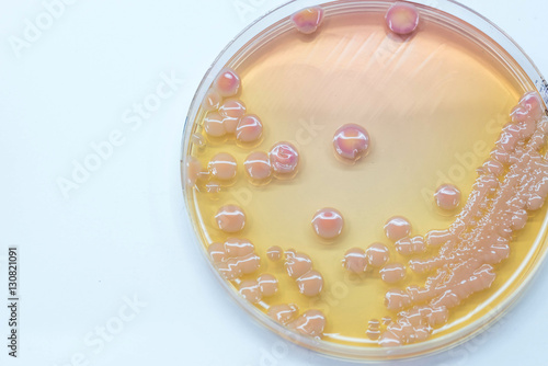 Klebsiella pneumoniae colonies, Gram negative bacilli colonies a